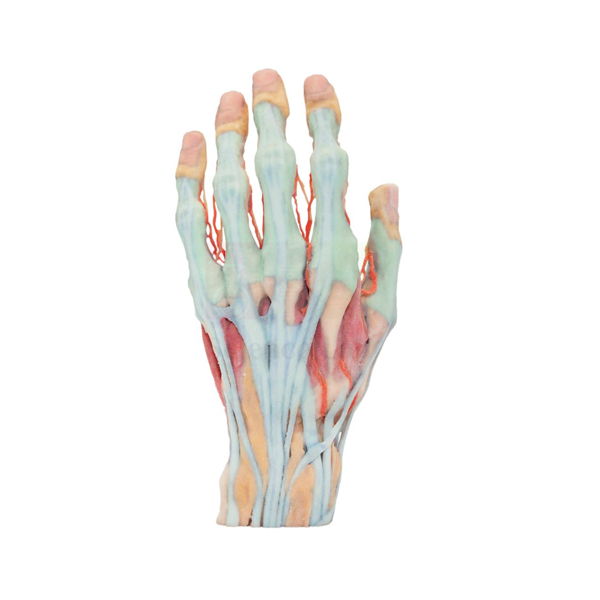 3-D Printed Human Superficial Hand Dissection Model